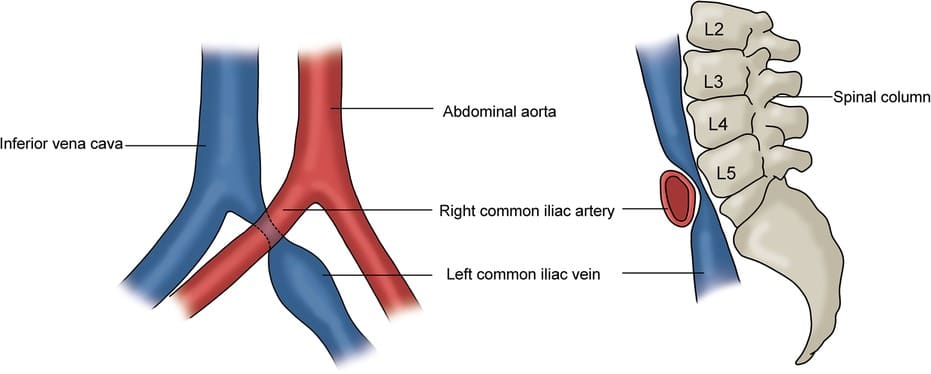 NIVL anatomy 3 NIVL anatomy 3