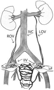 Pelvic venous anatomy 2 Pelvic venous anatomy 2