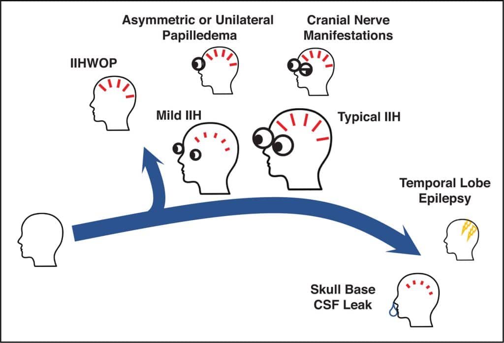 iih spectrum iih spectrum